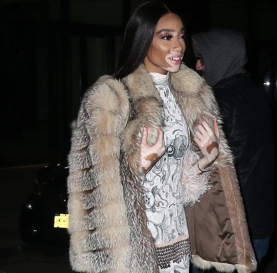 全世界公认的超模,最漂亮的白癜风超模