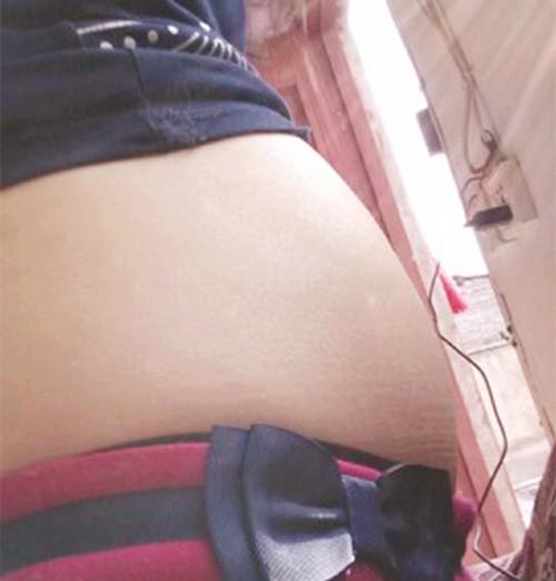 孕妇情绪低落导致胎儿流产,孕妇腹泻导致胎儿死亡