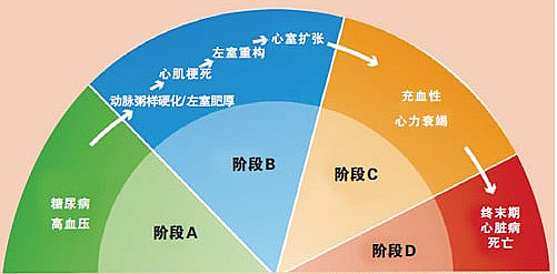 积极降压，精选药物，让高血压肥厚的心肌“瘦”回来！