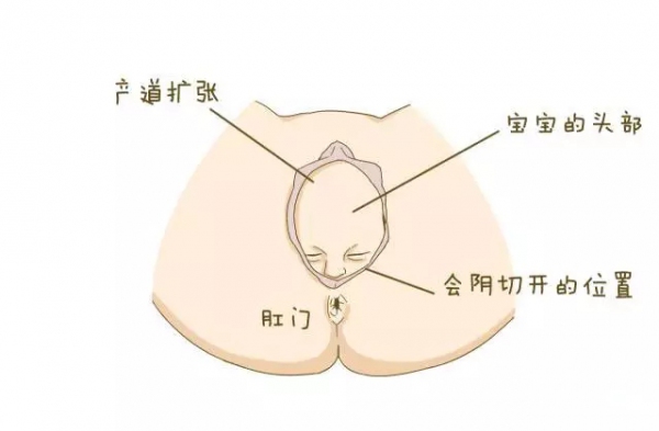 为什么女人顺产比剖腹产更容易,为什么现在顺产要侧切