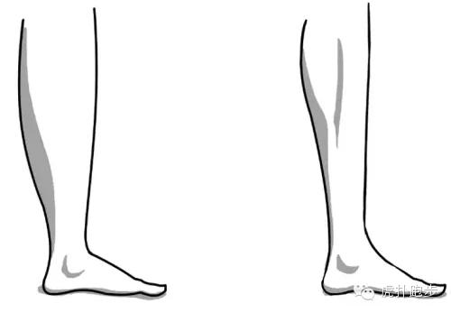 跑后拉伸完腿麻怎么回事,跑后不拉伸小腿真的会变粗