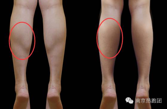 跑步不磨脚的最佳方法,跑步不瘦的秘诀