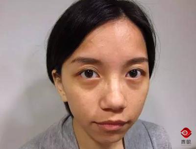 戴眼镜看字有重影是什么原因,戴眼镜重影是什么原因