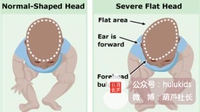 睡平头圆头,新生儿要睡圆头吗