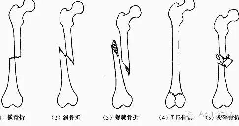 [干货]A6出品的《人伤速查手册收藏版》比莆田系医院靠谱多了