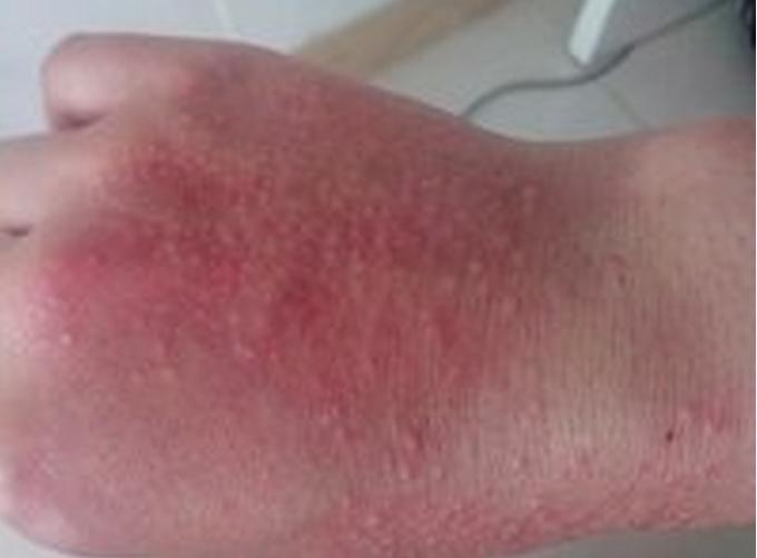 准妈妈应警惕孕期七种痛,准妈妈孕期七大禁忌