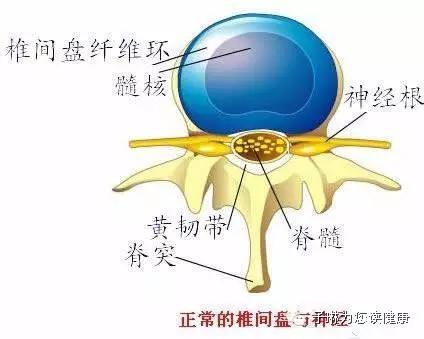 腰椎突出开刀手术要多久才能恢复,80%腰椎间盘突出症不需要手术