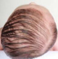 睡平头圆头,新生儿要睡圆头吗