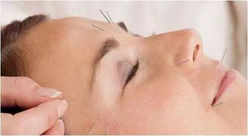 延缓衰老最好的针,针灸治疗抗衰老的教学视频