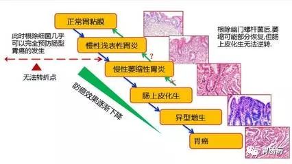 肠化是肠道出毛病了吗,胃萎缩肠化就是癌变的前兆吗