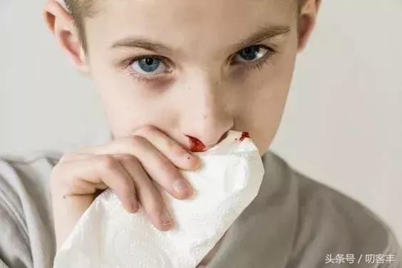 孩子流鼻血拿纸堵住一会就不流了,孩子流鼻血被血堵住了