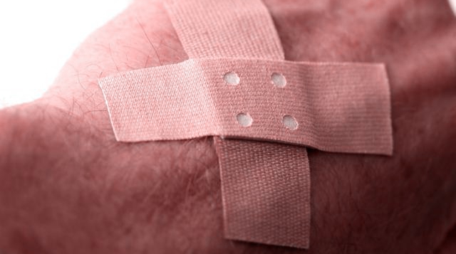 治疗骨关节炎的外用药有哪些,膝关节骨关节炎外用药如何治疗