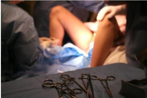 为什么女人顺产比剖腹产更容易,为什么现在顺产要侧切