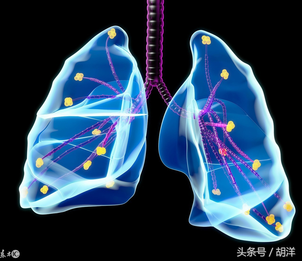 肺炎所致的感染性休克应视察什么,肺炎一定会出现的症状
