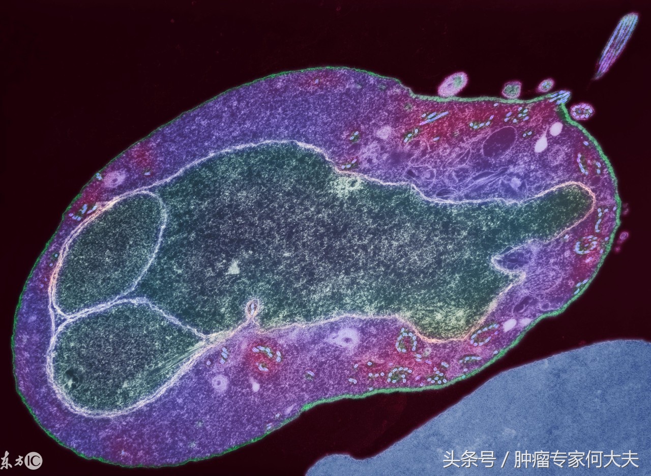 粪便移植可以治疗肠癌吗,粪菌移植治疗肠癌