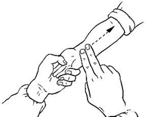 十宣穴的退热按摩法,小孩快速退热的按摩法