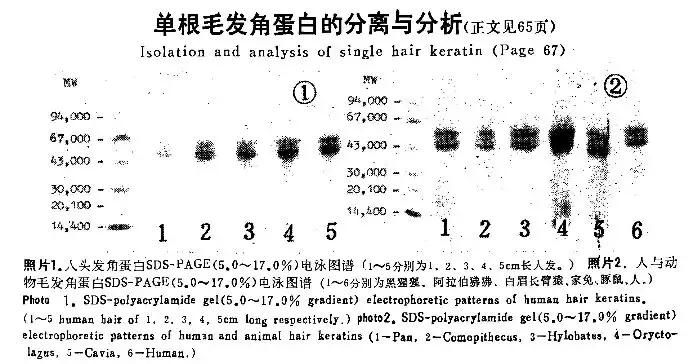 为什么用烟酰胺皮肤会变黄,烟酰胺原液用了会长毛吗