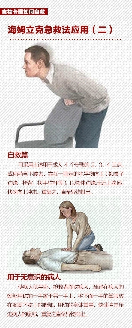 大人异物卡在喉咙妙招,孩子被异物卡喉怎么处理才靠谱