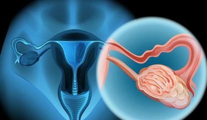 子宫肌瘤8公分要做开腹手术吗,子宫肌瘤加宫颈囊肿要子宫全切吗