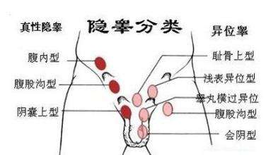 男人“蛋蛋”越大越好？小心这几种病！