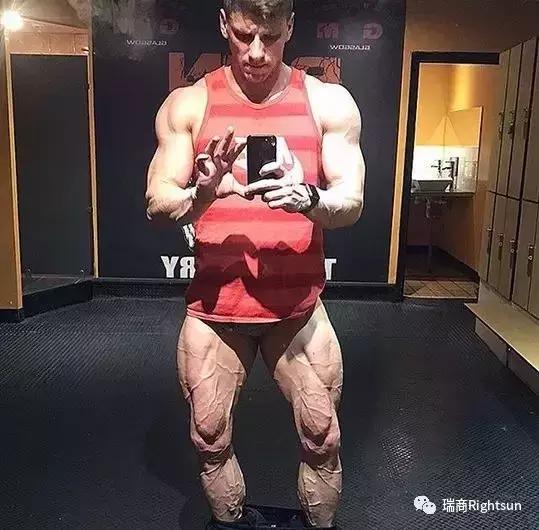 健美冠军体脂率是多少,26岁健美冠军小腿静脉爆裂