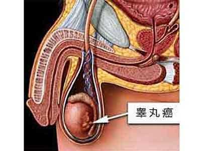 男人“蛋蛋”越大越好？小心这几种病！