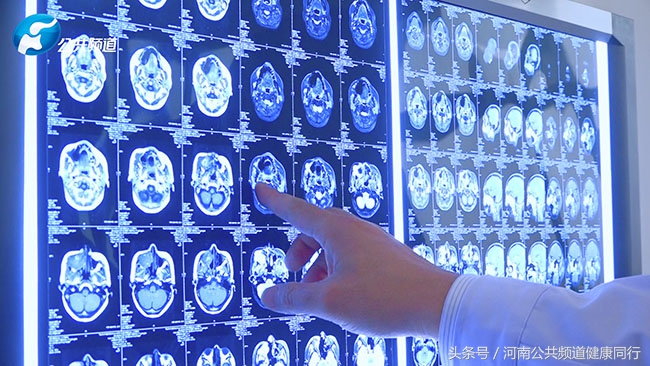 杨道科郑大一附院肿瘤医院院长,郑大一附院肿瘤医院杨道科团队