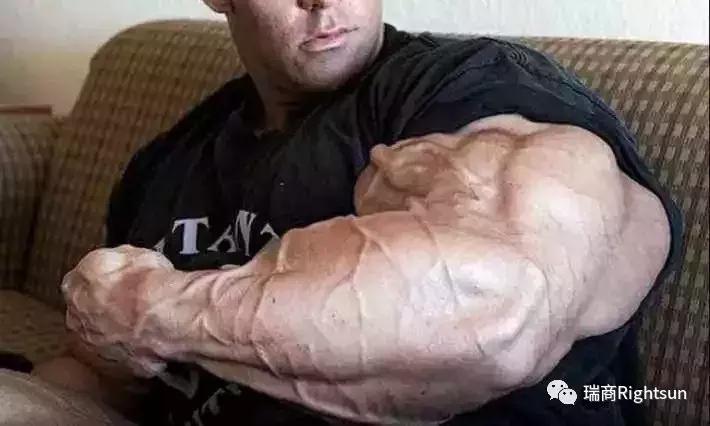 健美冠军体脂率是多少,26岁健美冠军小腿静脉爆裂