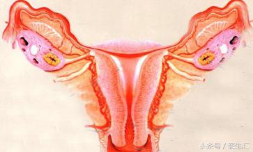 病例分析原发闭经的诊断思路,临床诊断53岁女性闭经