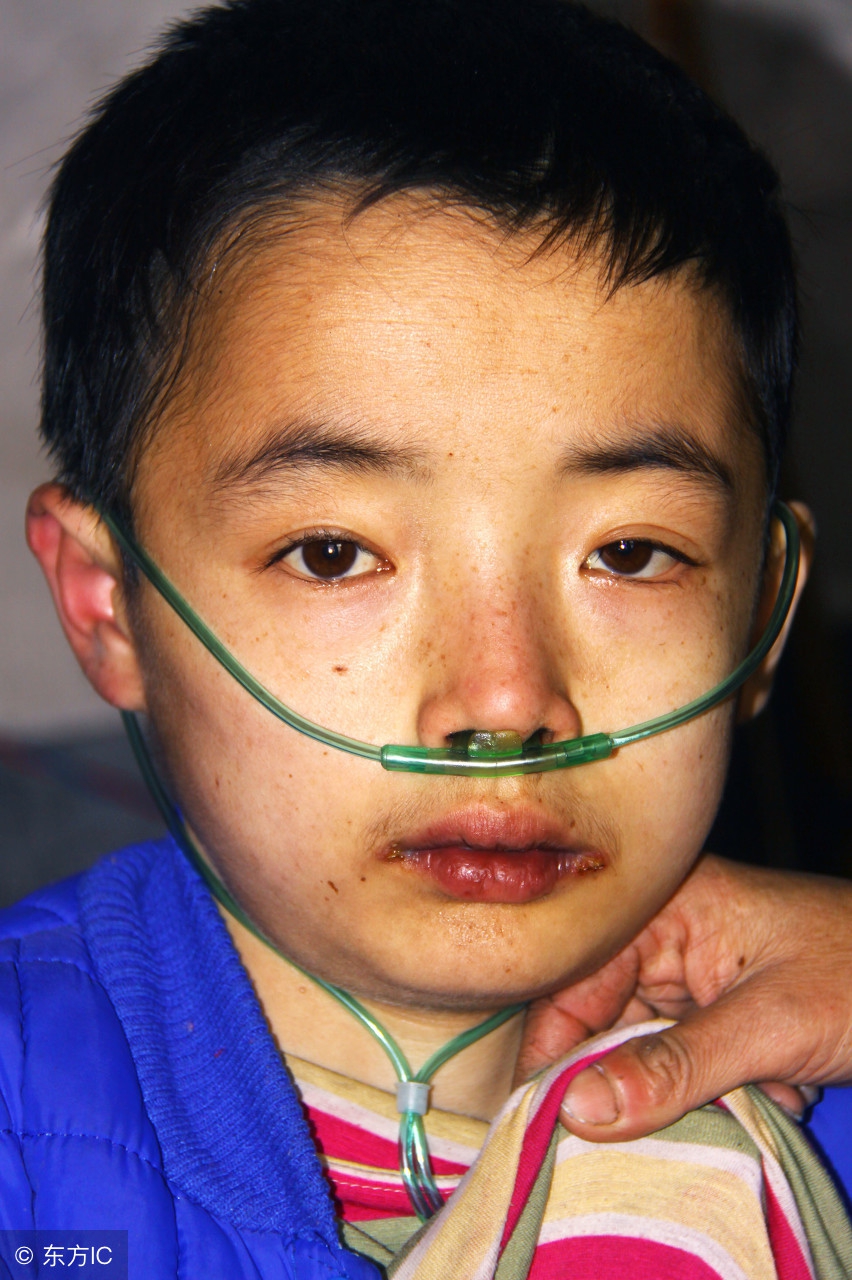 心力衰竭的病人为什么要低盐饮食,心力衰竭的患者饮食关注事项