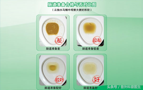 肠镜检查是怎么做的,胃镜肠镜检查前关注事项及禁忌症