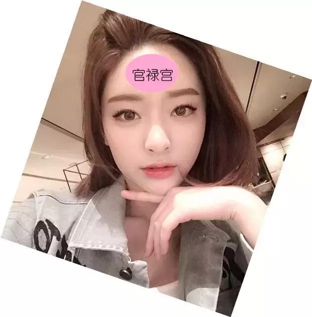 AnnaG教你整｜丰额头，能增加运气吗？