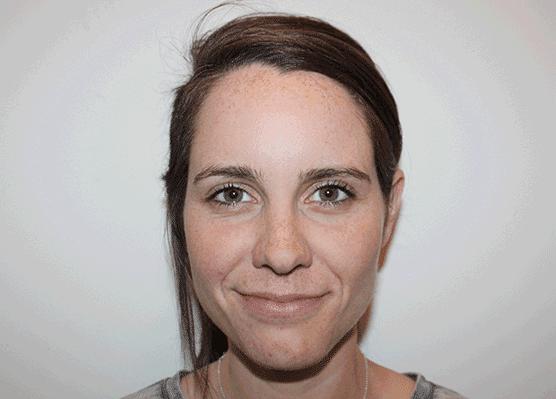 大脸怎么变小脸医美,大脸如何变巴掌脸