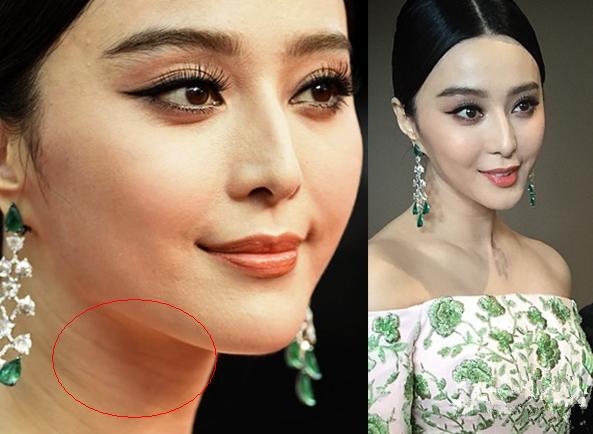 暴露年龄的细节,暴露年龄的表现