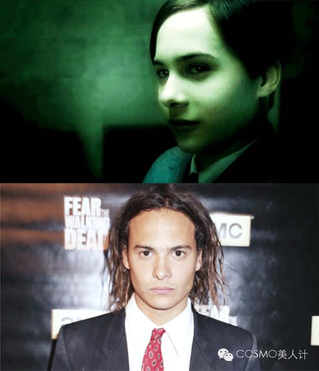 断头发怎样护理,断头发怎么治疗最有效