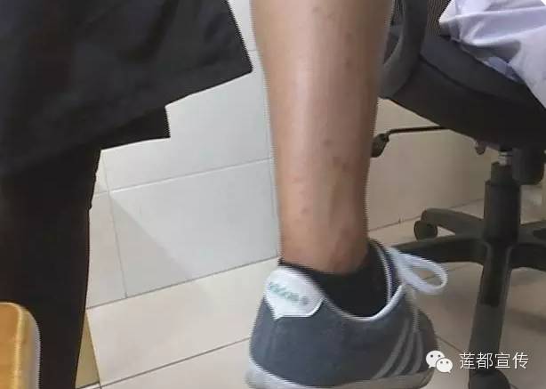 丽水医院最新消息,关注丽水市中心医院