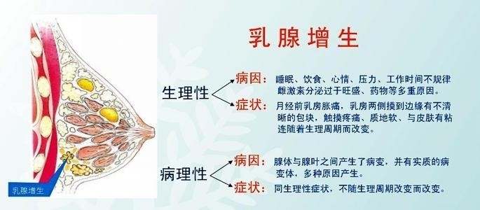 治疗乳腺增生囊肿的家用调理方法,乳腺增生有肿块吃药能消退吗