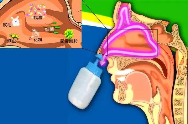 冬天感冒洗个冷水澡就好了,冬季感冒鼻子堵塞有妙招