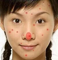 痘痘是身体什么地方出了问题,痘痘告诉你哪里生病了