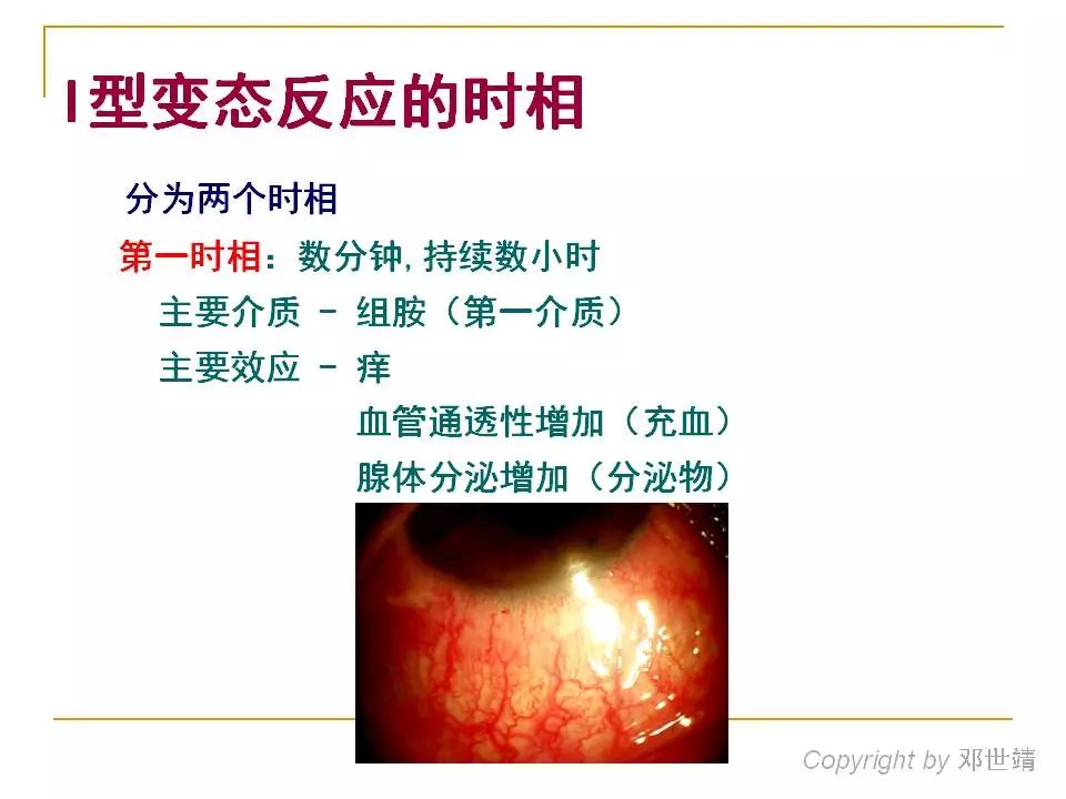 眼睛过敏如何预防,治疗眼周围过敏方法