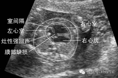 超声检测是怎么查的,超声检查你需要了解这几个问题