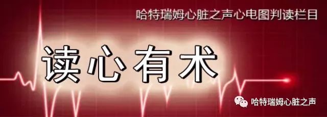 「读心有术」329期：电轴极度左偏，病因有两种