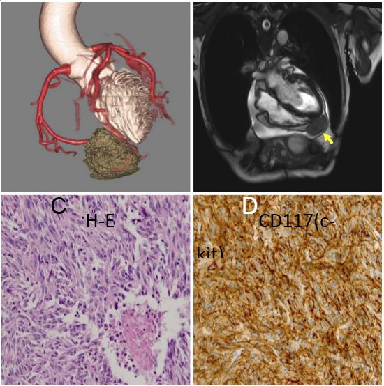 pubmed综述论文,pubmed文献全文