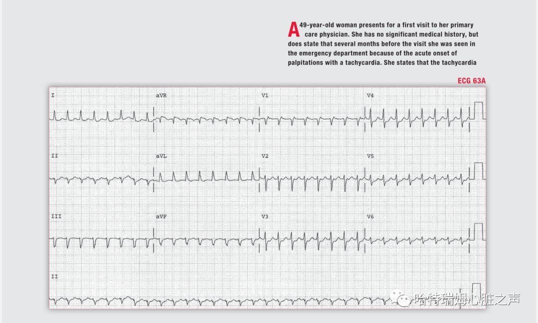 「读心有术」329期：电轴极度左偏，病因有两种