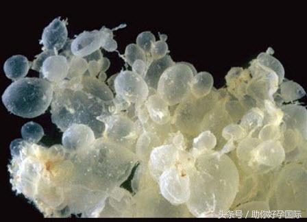 助你好孕,孕早期肚子隐隐作痛出血