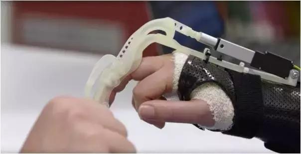 骨折后为什么要康复训练,什么是骨折后的康复治疗