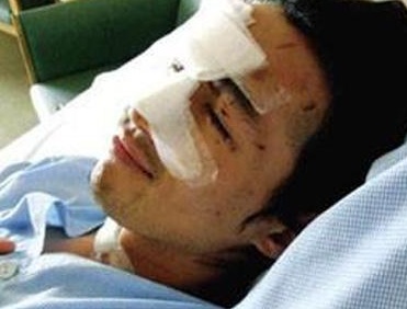 情人节“*力暴**亲热”！做过隆鼻后会被撞歪？