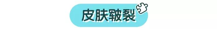 冬季宝宝皮肤护理秘籍,宝宝冬季护肤全攻略