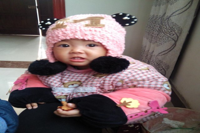 宝宝冬天手长冻疮,宝宝冻疮的原因及治疗方法