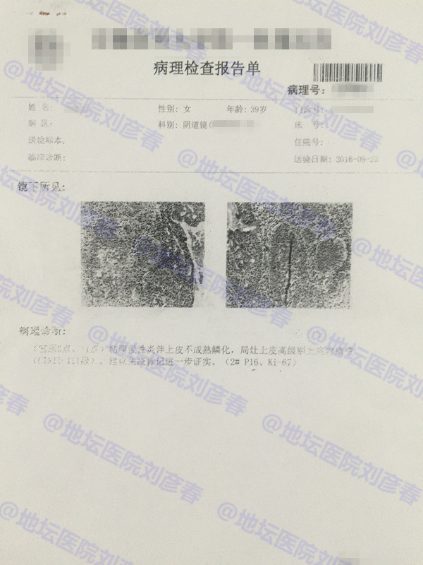 hpv病例分享2016,病例分享报告
